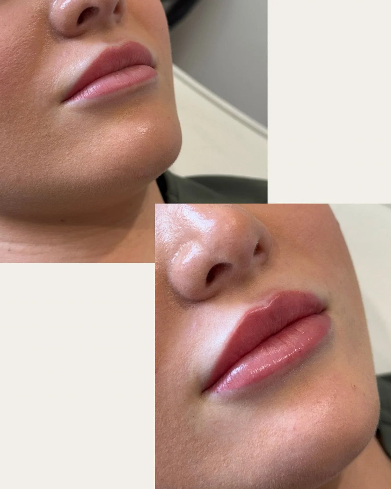 Defined. Hydrated. Balanced.
Results that respect your natural features.

MEDICAL DISCLAIMER:
This content is for information and educational purposes only and is not intended to be a substitute for professional individualised medical advice, diagnos