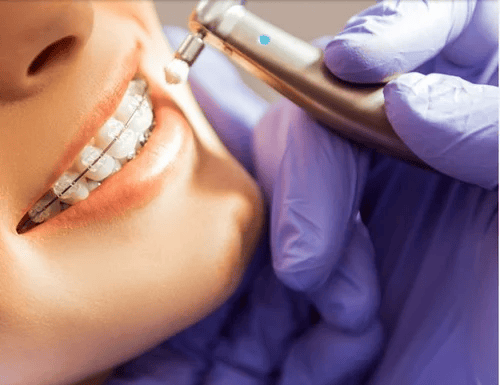 orthodontics-service-500x500.png
