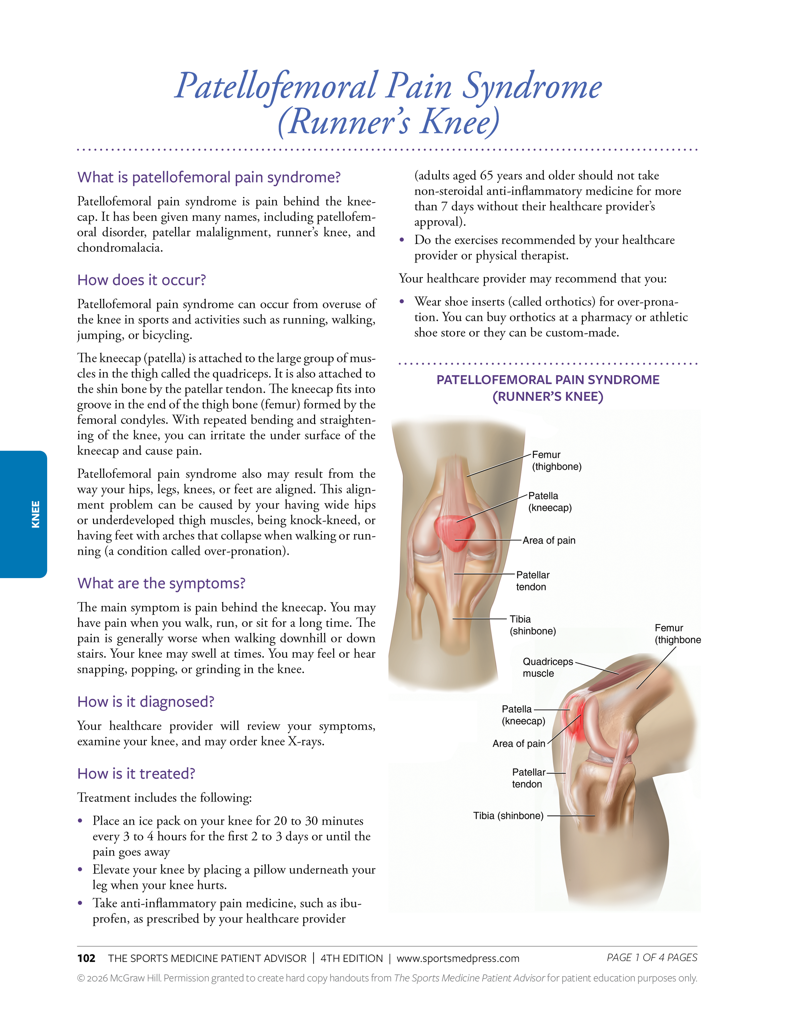 Diagram of kneecap with labels pointing to femur, patella, quadriceps muscle, tibia, and patellar tendon, highlighting areas of pain related to runner's knee.