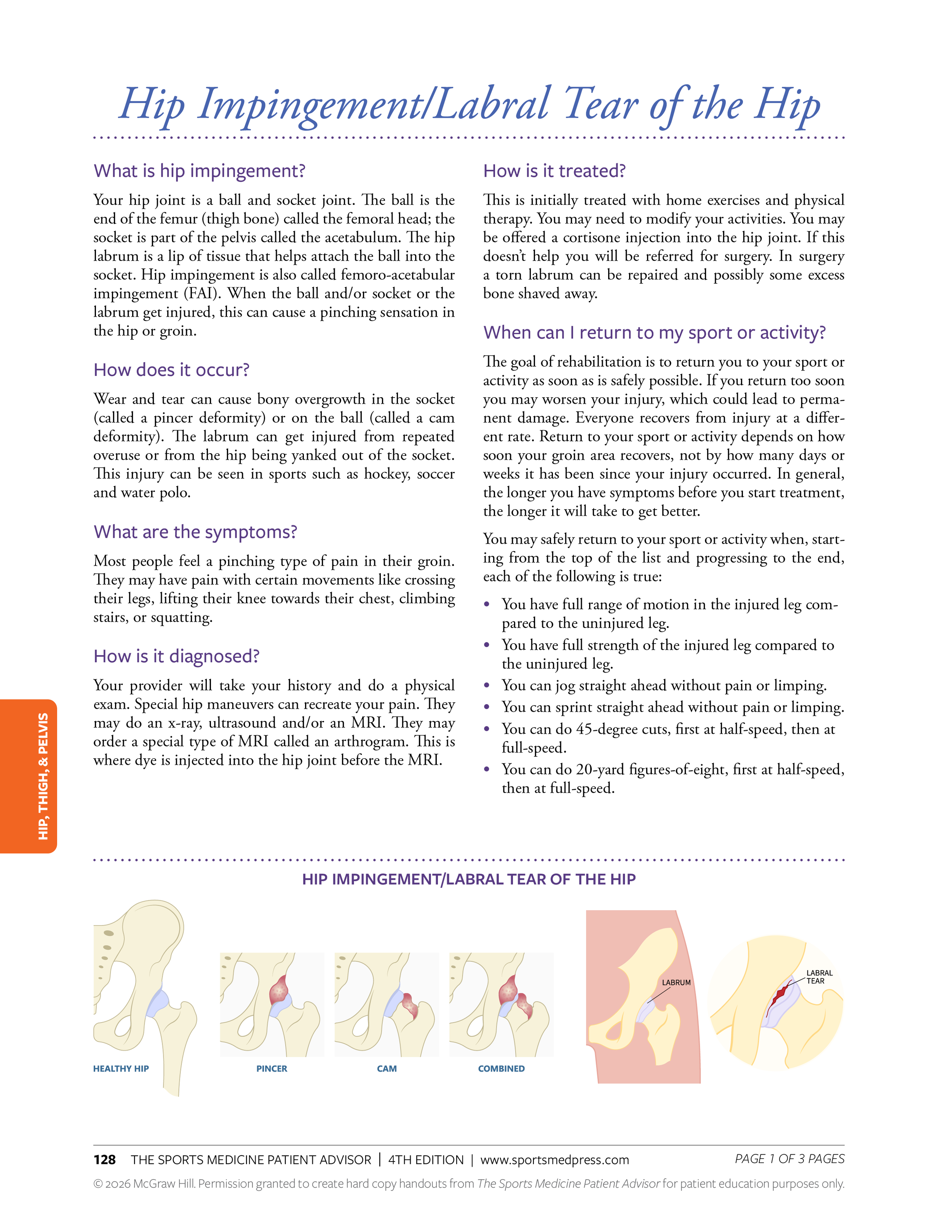 Illustration showing healthy hip, pincher, cam, and combined deformities, along with diagrams of hip impingement and labral tear of the hip.