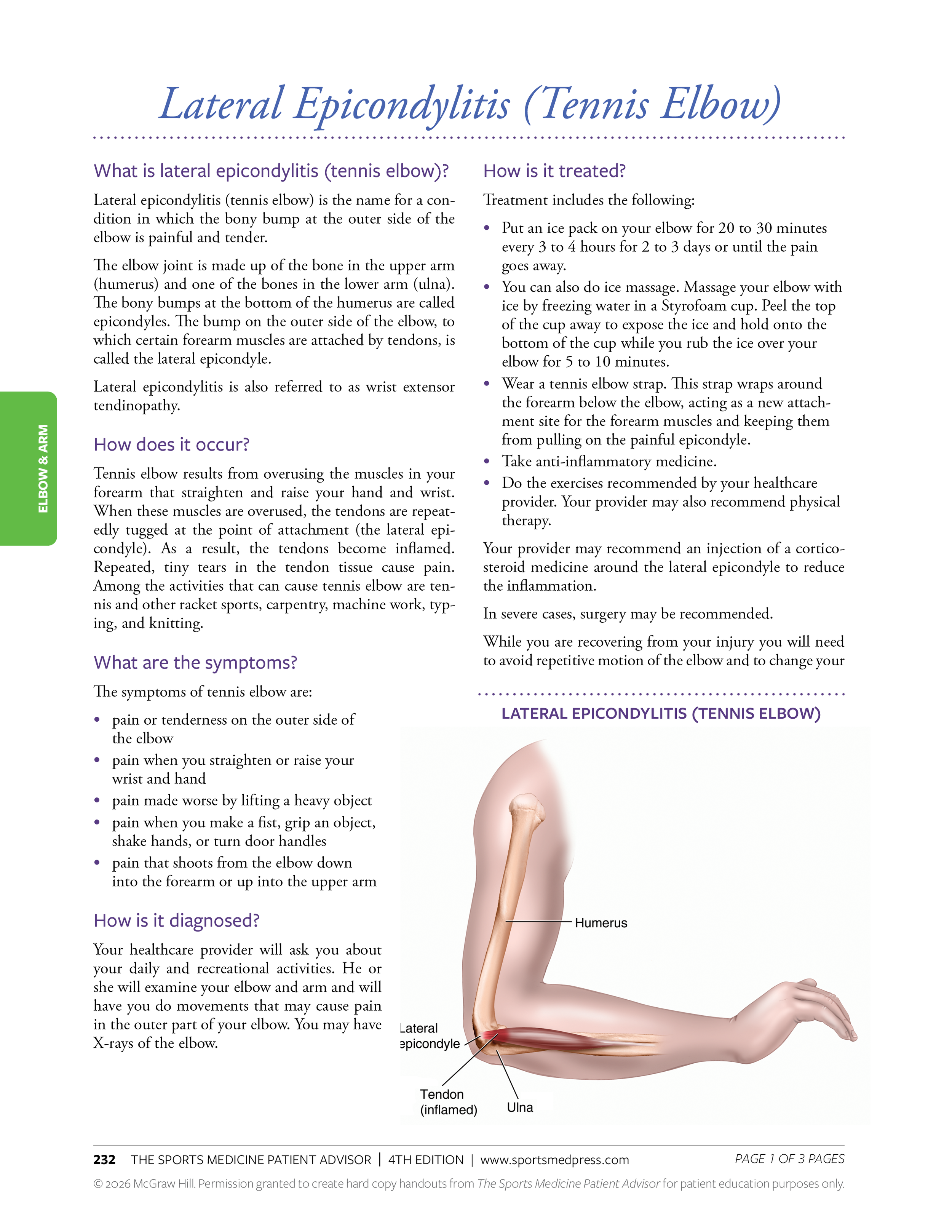 An informational page about Lateral Epicondylitis (Tennis Elbow) including symptoms, causes, treatment options, and a diagram of an elbow showing the humerus, lateral epicondyle, ulna, tendon, and inflamed area.