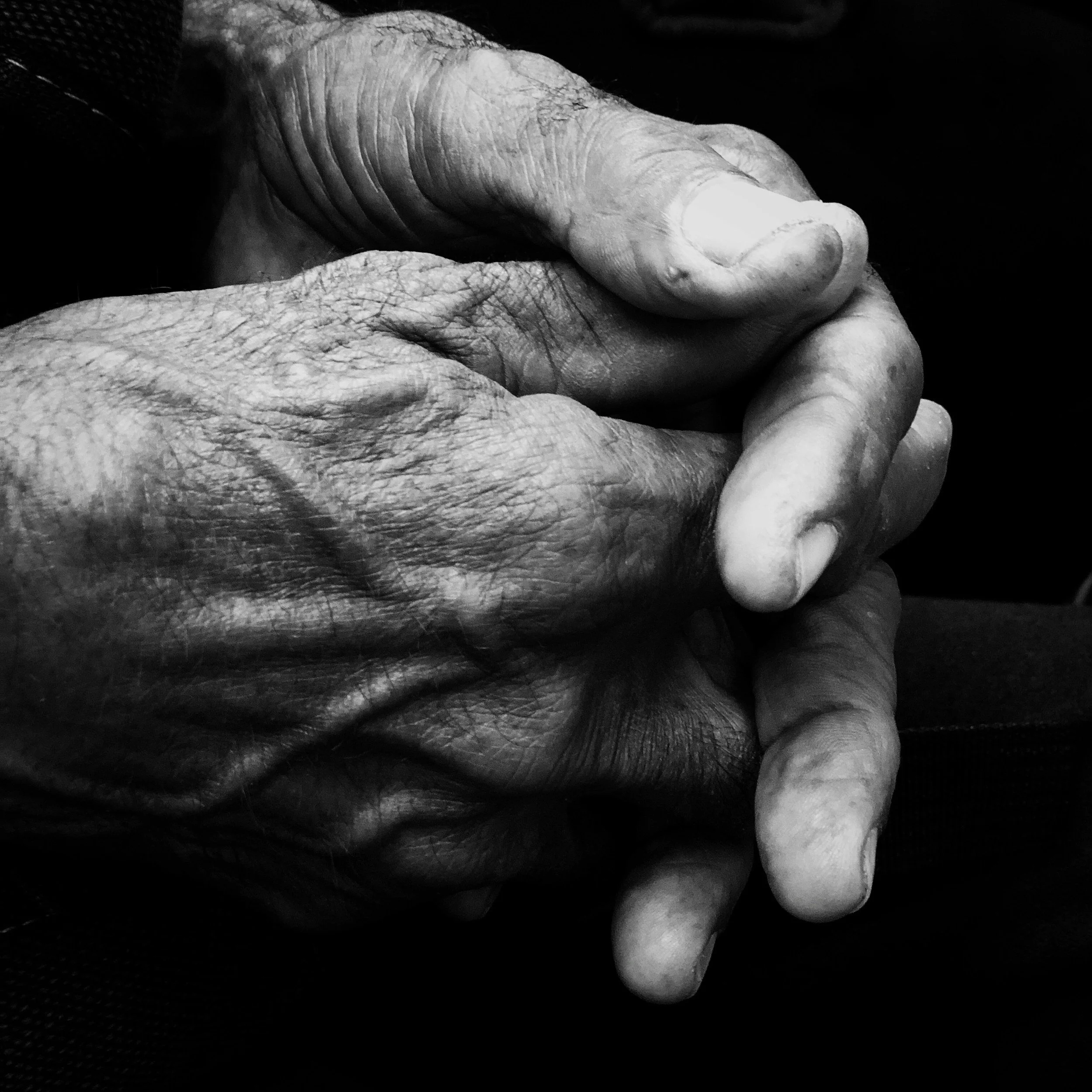 Hand Arthritis: How Physiotherapy and MLS Laser Therapy Can Help