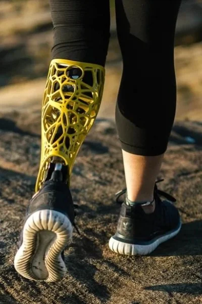 Close-up of a person walking outdoors, showing their 3d printed prosthetic leg with a yellow, lattice-like cover and black athletic shoes.