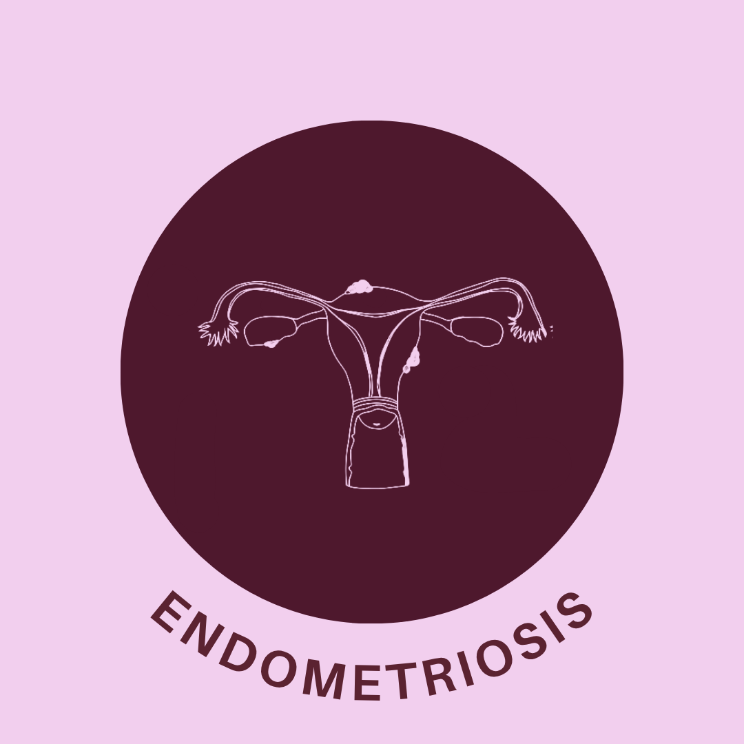 Endometriosis