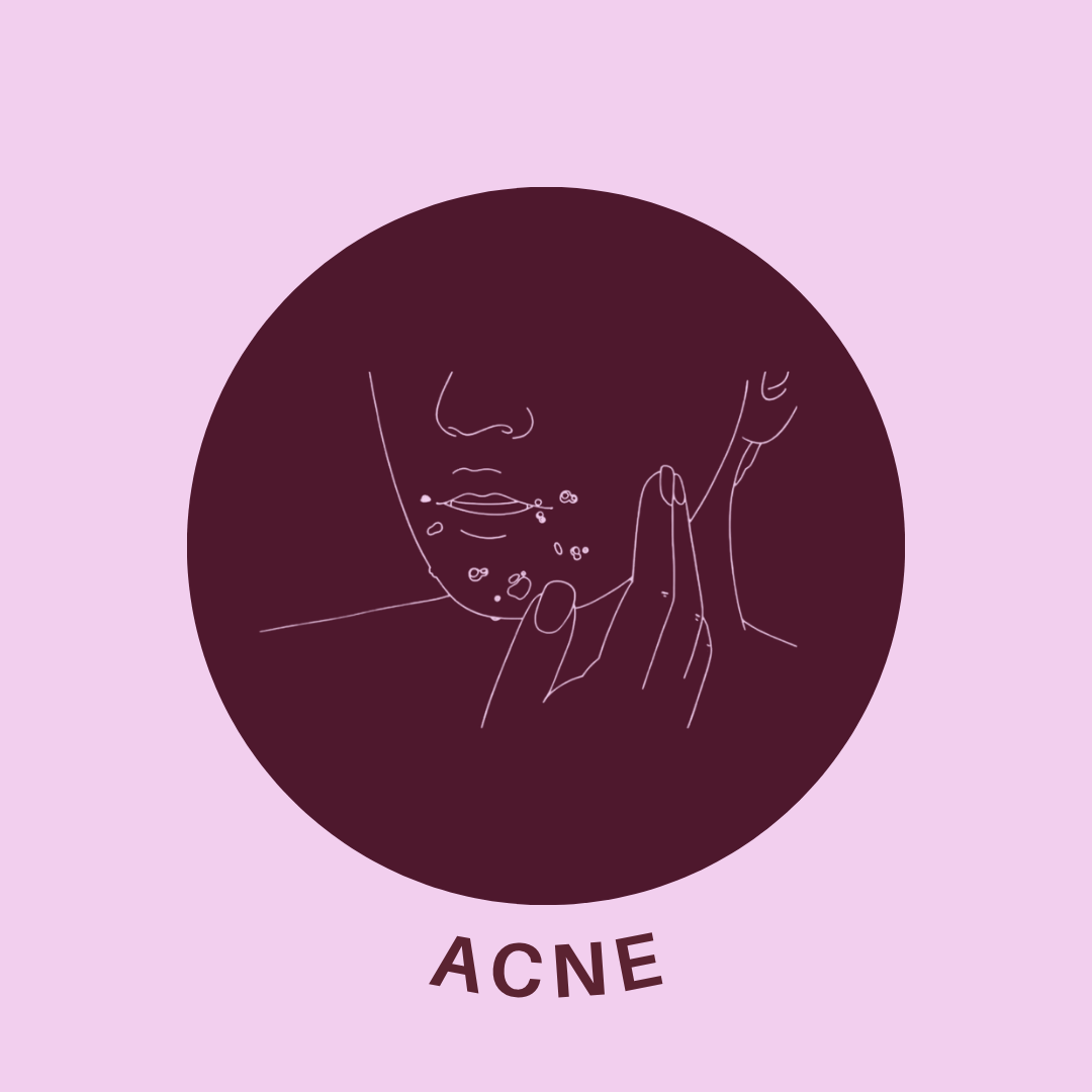 Acne, cystic acne