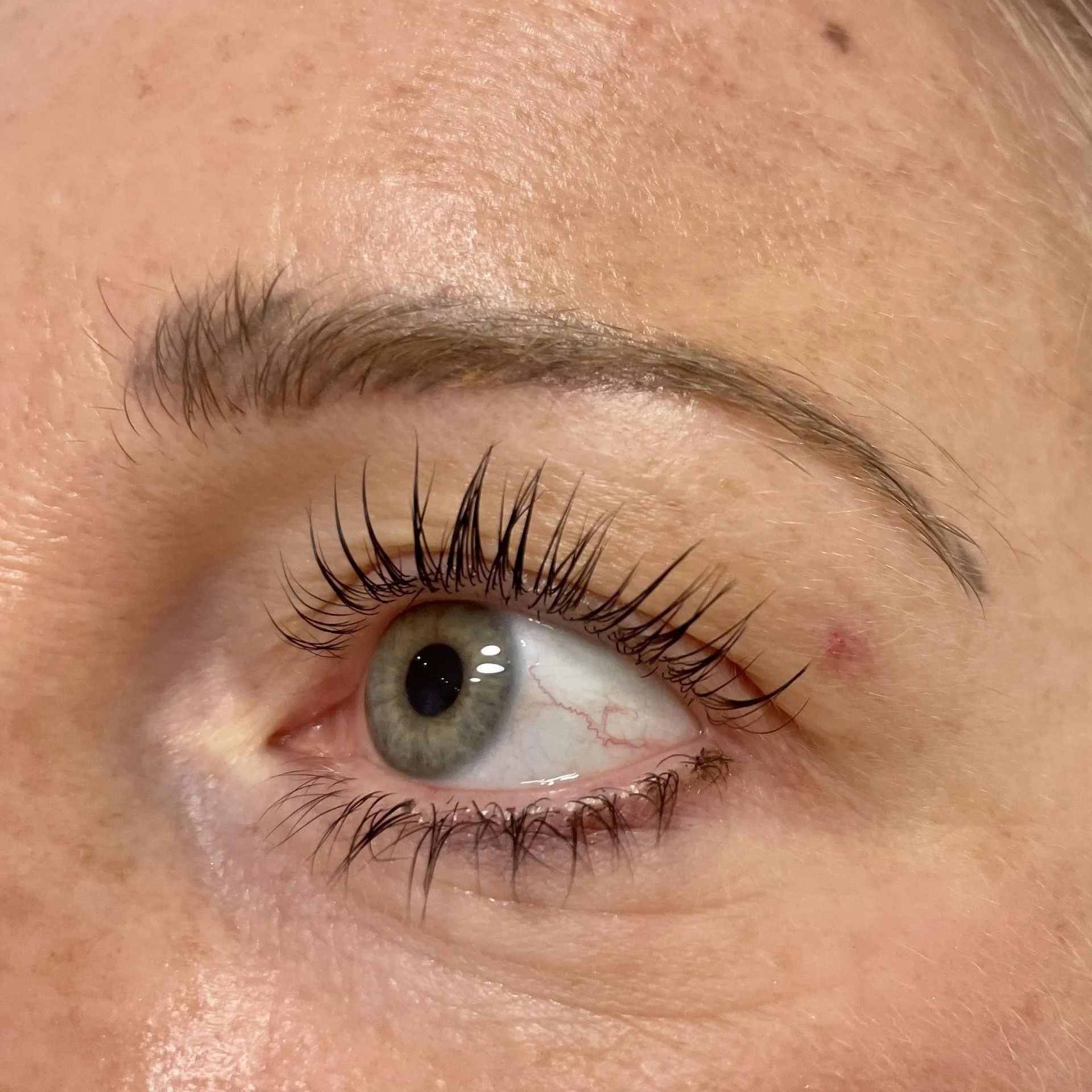 Close-up of a human eye with long eyelashes and a slightly raised area on the skin near the eyebrow.