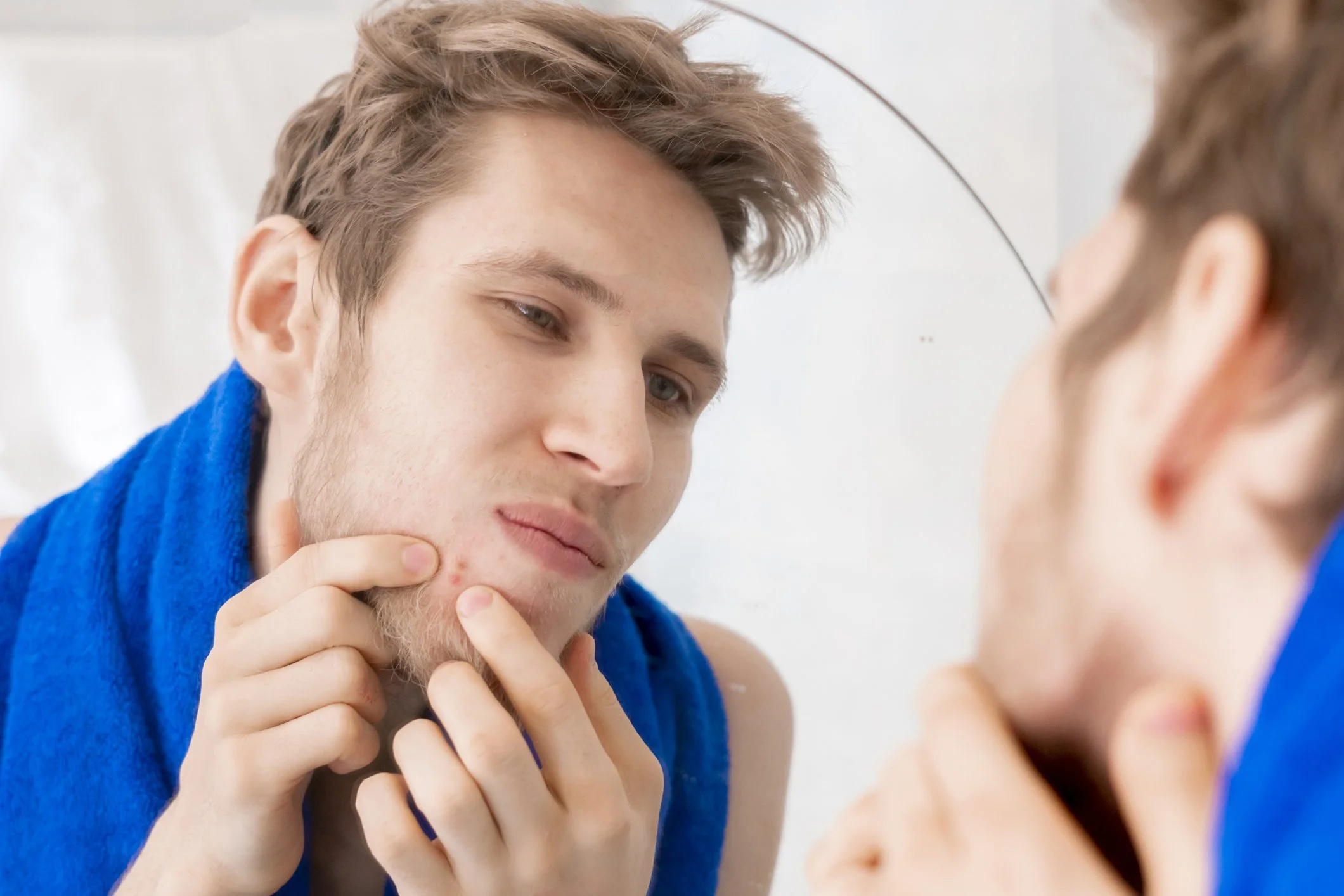 Ein junger Mann mit braunen Haaren und blauen Augen betrachtet sein Spiegelbild. Er trägt einen blauen Bademantel und hat Pickel im Gesicht.