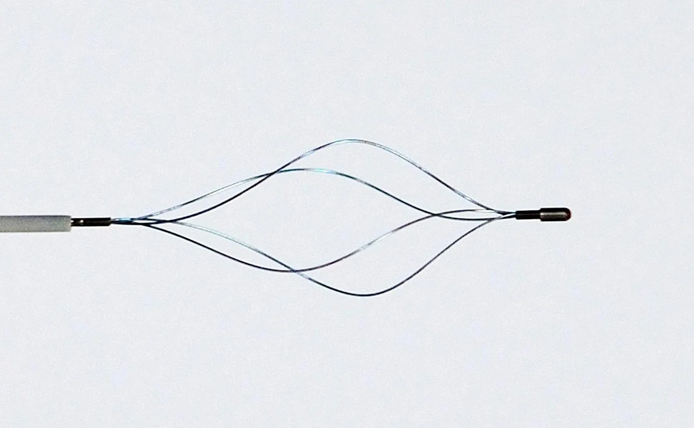 A nitinol vascular implant attached to a percutaneous delivery system.