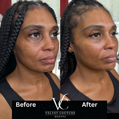 Face & Contour, before & after, photo 9 of 31