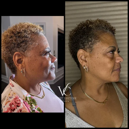 Face & Contour, before & after, photo 21 of 31