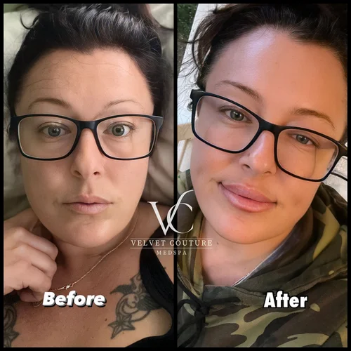 Skin & Glow, before & after, photo 19 of 28
