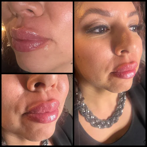 Lips, before & after, photo 22 of 26