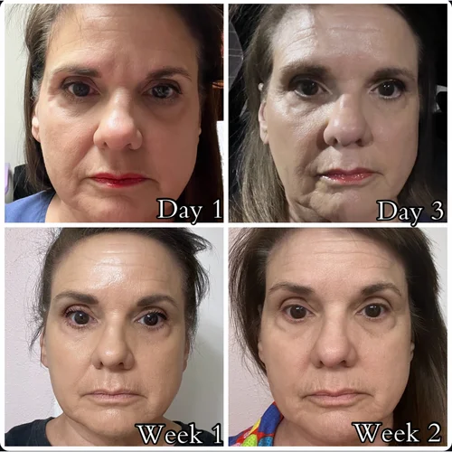 Skin & Glow, before & after, photo 25 of 28