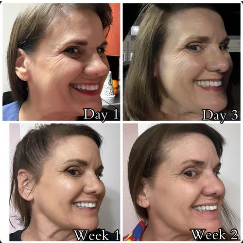Skin & Glow, before & after, photo 24 of 28