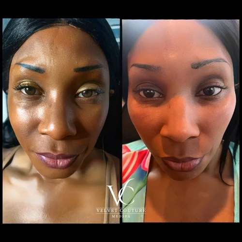Skin & Glow, before & after, photo 23 of 28