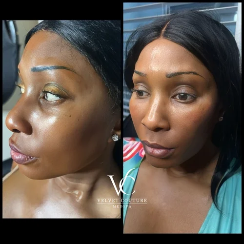 Skin & Glow, before & after, photo 22 of 28
