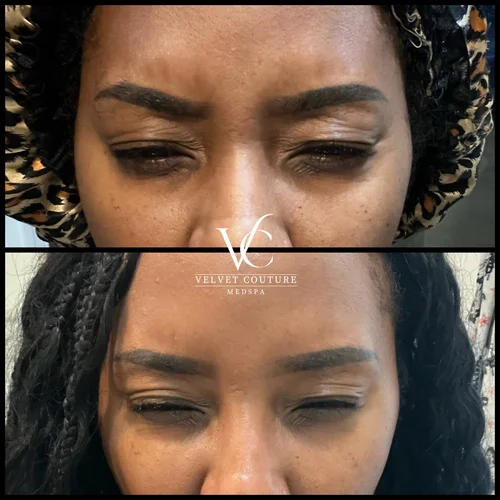 Smooth Lines, before & after, photo 5 of 15