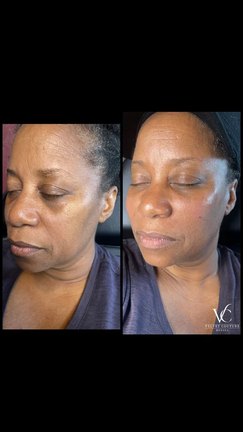 Skin & Glow, before & after, photo 28 of 28