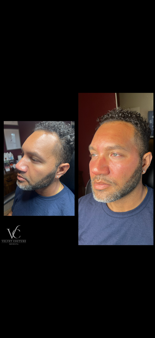 Skin & Glow, before & after, photo 27 of 28