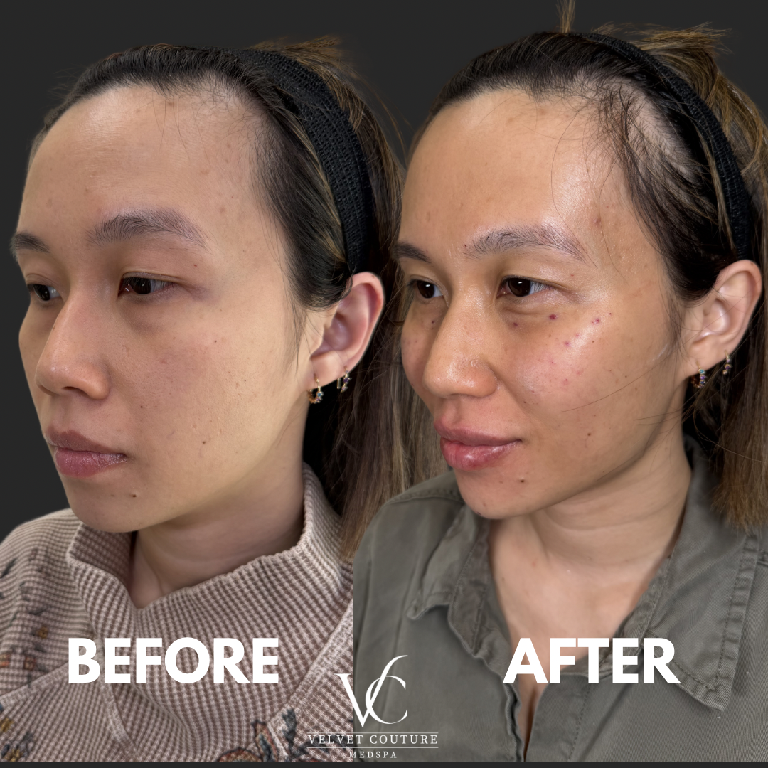 Brown Minimalist Skincare Before After Collage Instagram Post.png