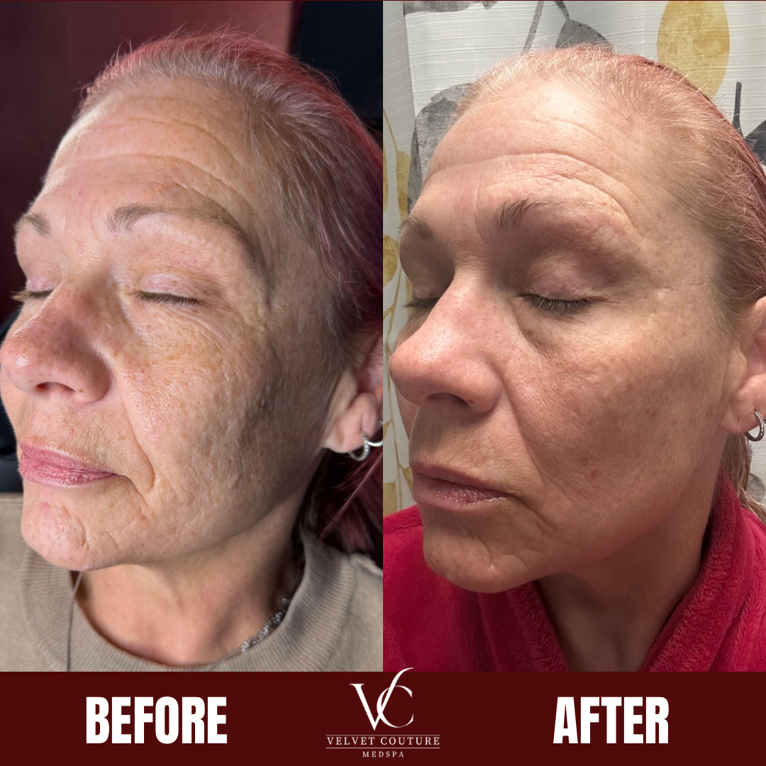 Brown Minimalist Skincare Before After Collage Instagram Post.png