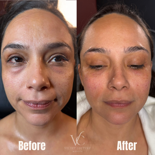 Skin & Glow, before & after, photo 17 of 28