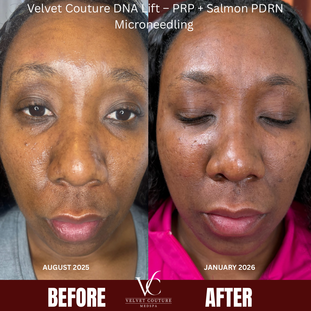 Brown Minimalist Skincare Before After Collage Instagram Post.png