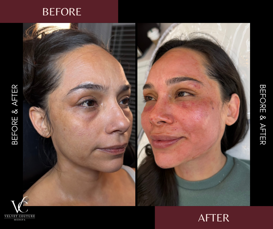 Before and After Minimal Photocentric facebook post.png