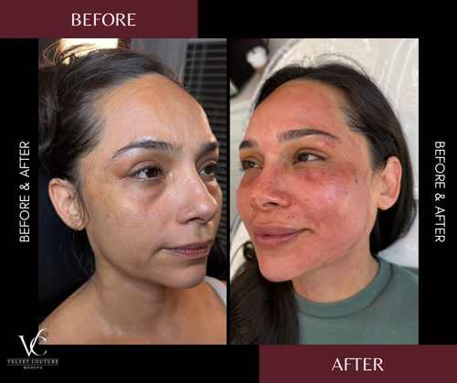 Skin & Glow, before & after, photo 21 of 28