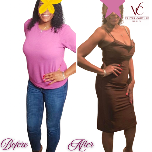 Body & Wellness, before & after, photo 3 of 4