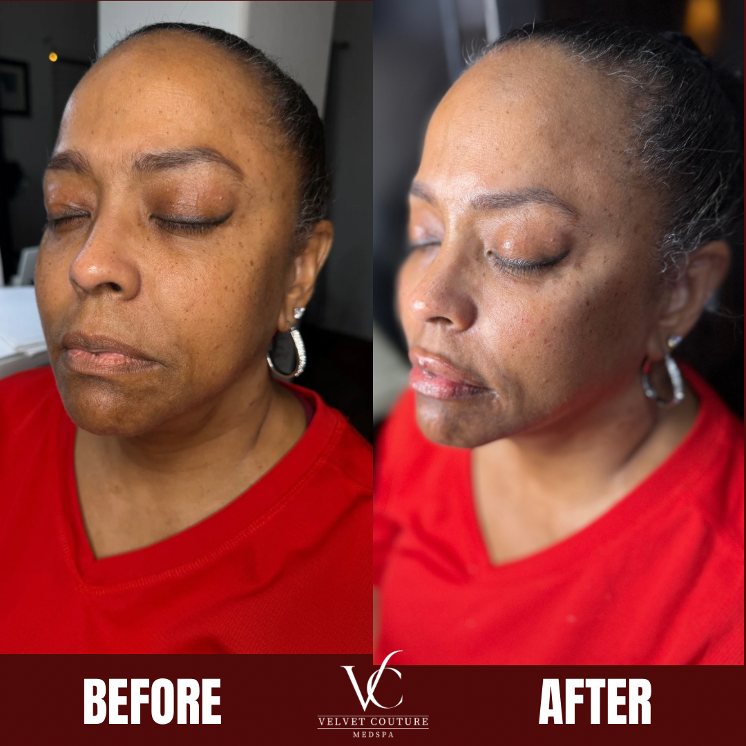 Brown Minimalist Skincare Before After Collage Instagram Post.png