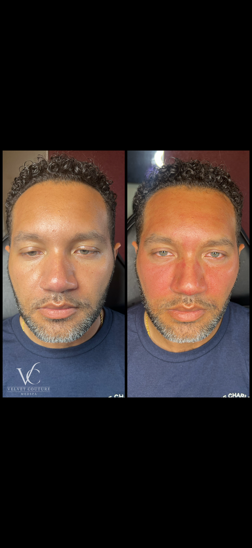 Skin & Glow, before & after, photo 26 of 28