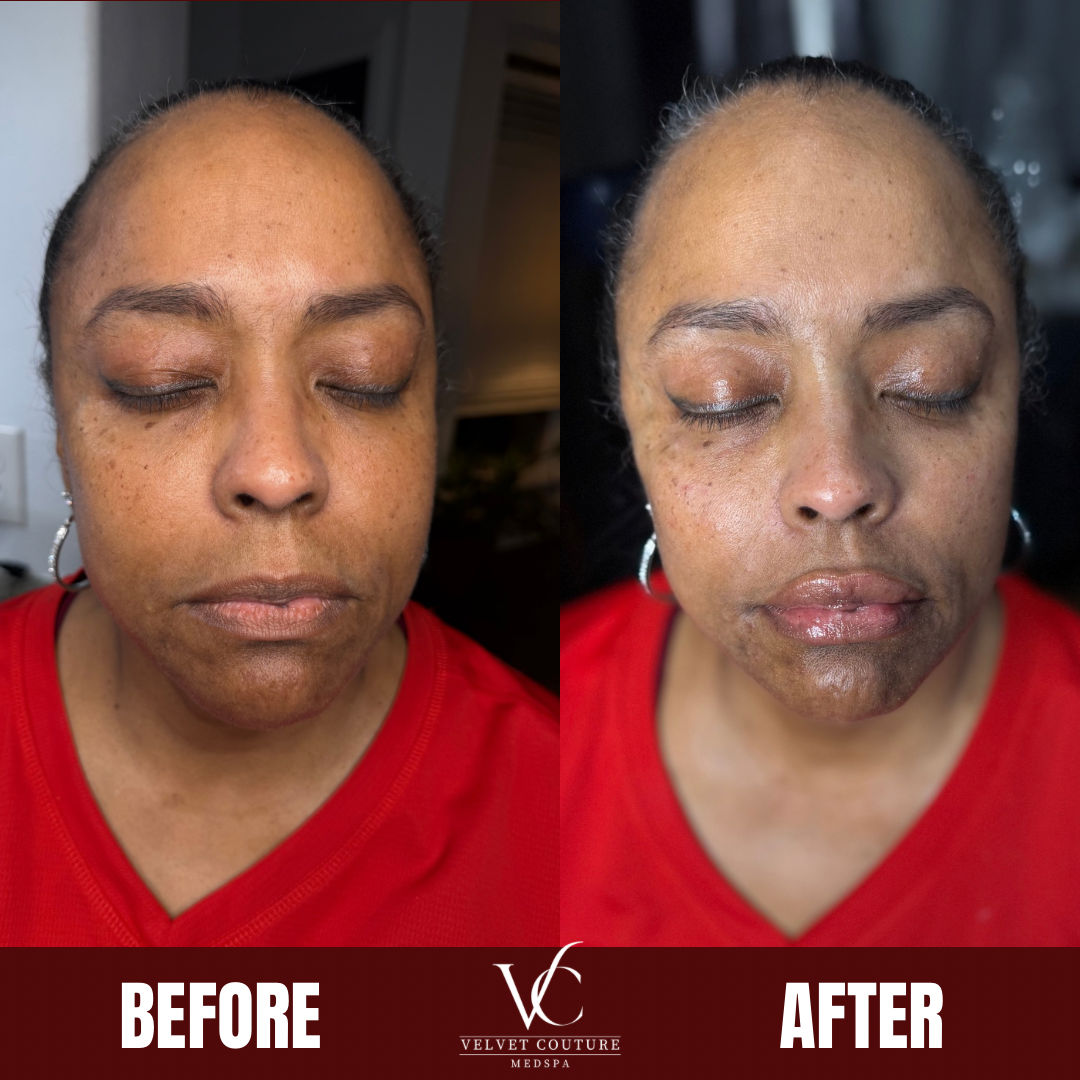 Brown Minimalist Skincare Before After Collage Instagram Post.png