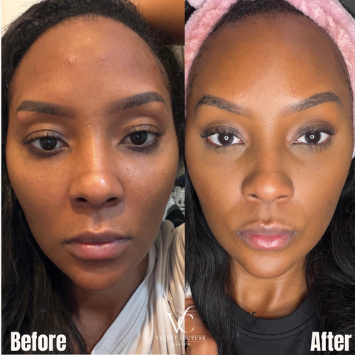 Face & Contour, before & after, photo 2 of 31