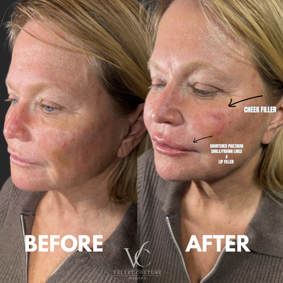 Brown Minimalist Skincare Before After Collage Instagram Post.png