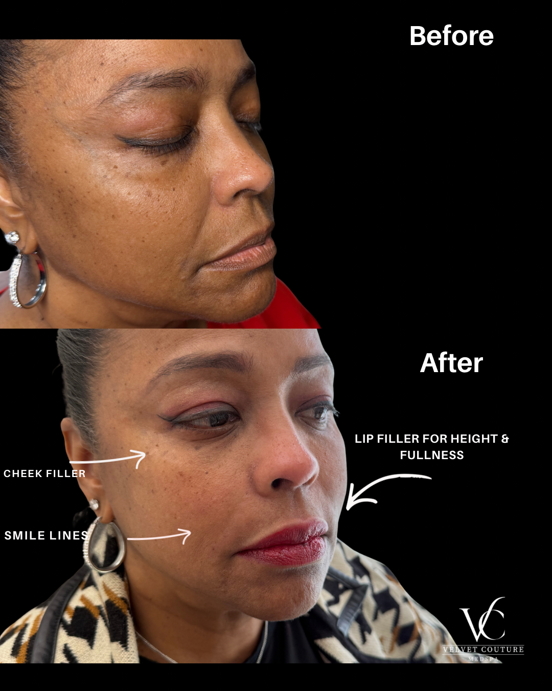 Green and Beige Minimalist Skincare Before After Collage Instagram Post - 2.png