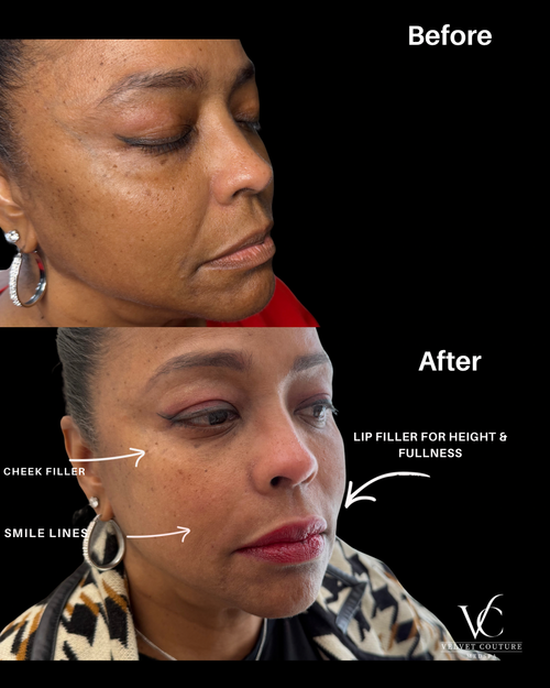 Skin & Glow, before & after, photo 16 of 28