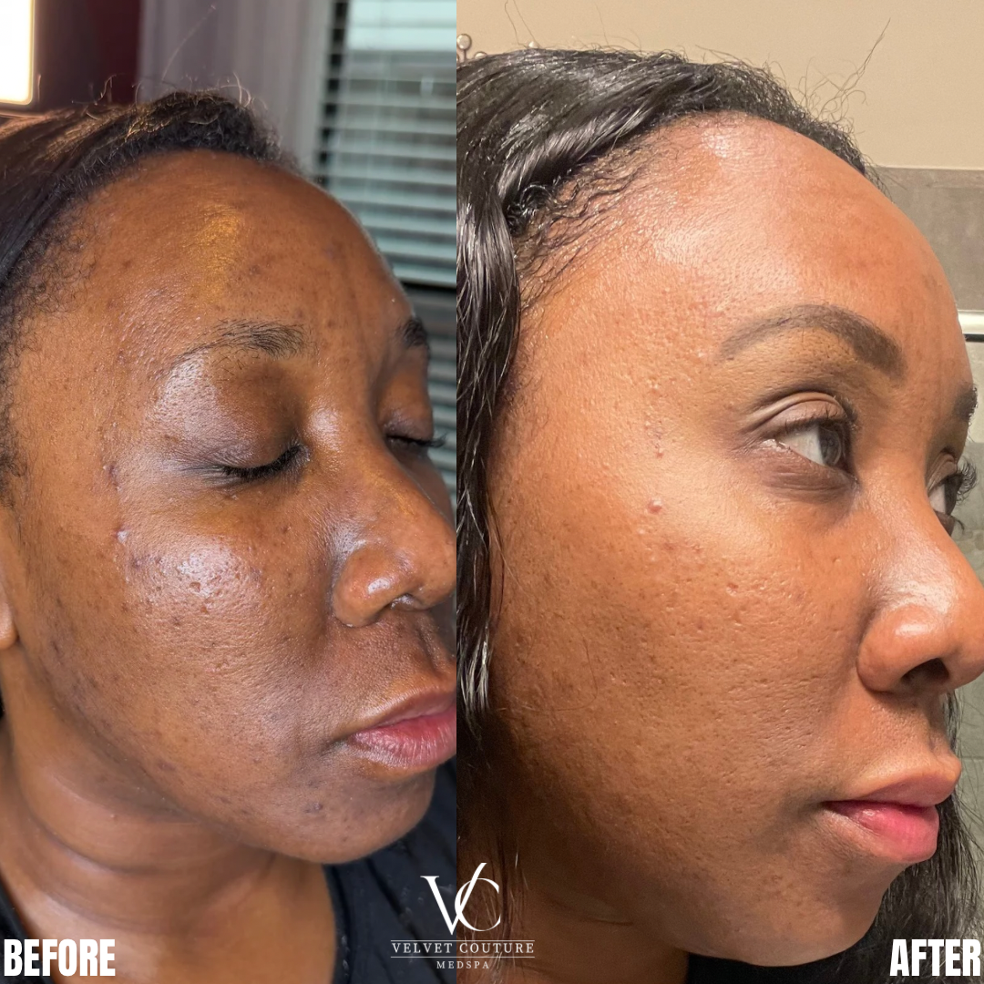 Brown Minimalist Skincare Before After Collage Instagram Post.png