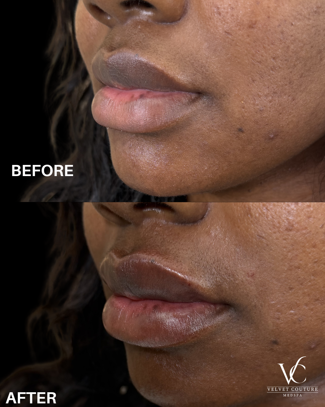 Green and Beige Minimalist Skincare Before After Collage Instagram Post - 1.png