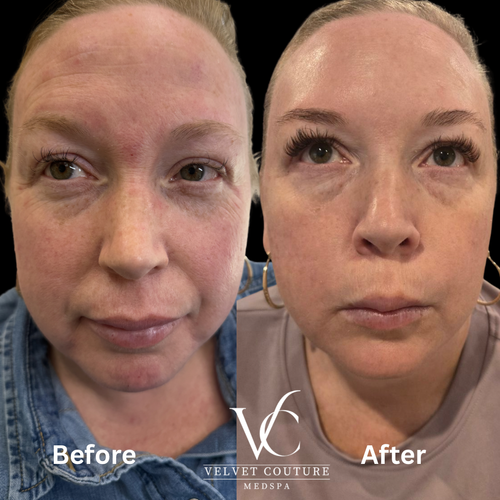 Face & Contour, before & after, photo 26 of 31