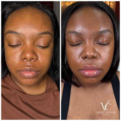 Skin & Glow, before & after, photo 2 of 28