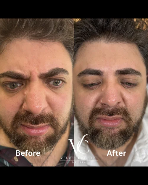 Smooth Lines, before & after, photo 8 of 15