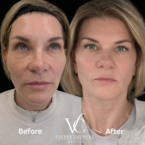 Face & Contour, before & after, photo 11 of 31