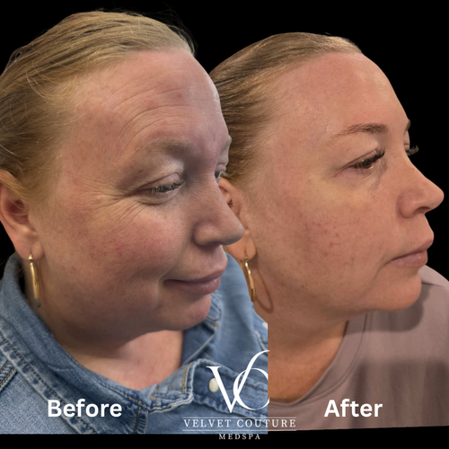 Face & Contour, before & after, photo 28 of 31