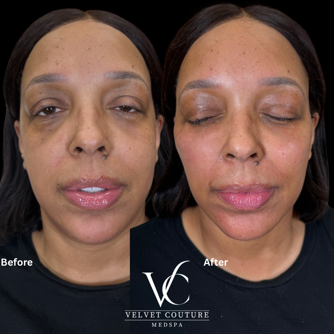 Beige Minimalist Skincare Before and After Instagram Post.png