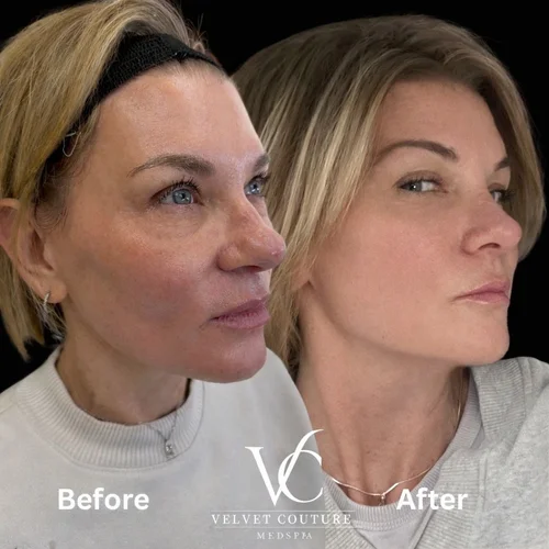 Face & Contour, before & after, photo 24 of 31
