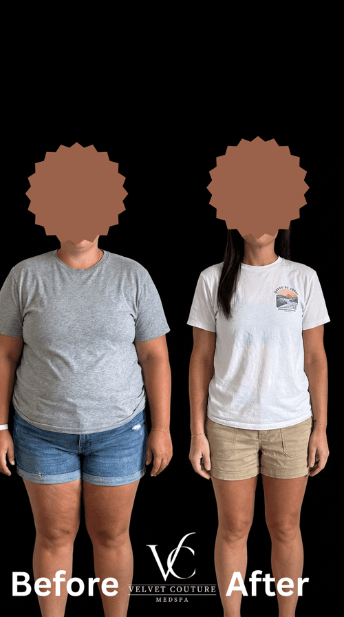 Body & Wellness, before & after, photo 2 of 4