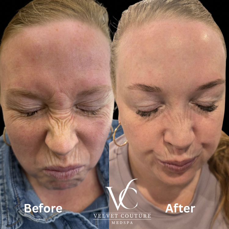 Client before and after, face. Individual results vary.