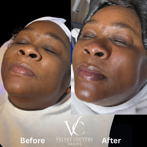 Skin & Glow, before & after, photo 8 of 28