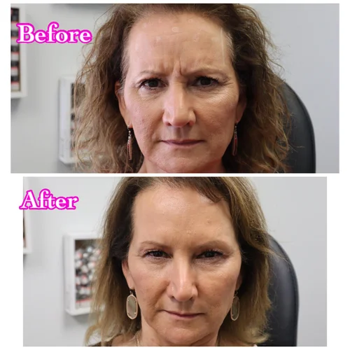 Face & Contour, before & after, photo 27 of 31